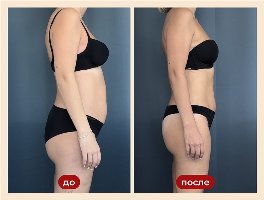 Результат участницы: до и после